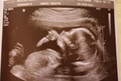 meetbaby4.jpg