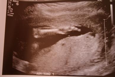 meetbaby5.jpg