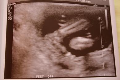 meetbaby6.jpg