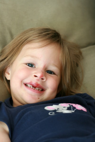 missing tooth