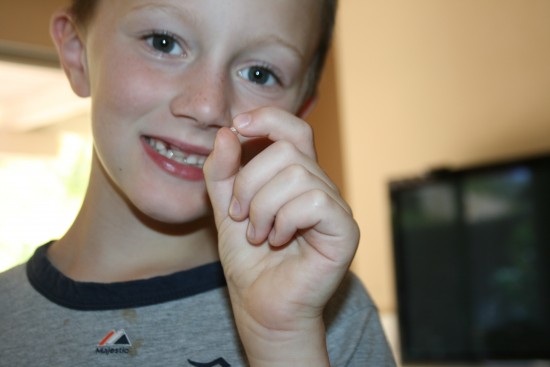 Tommy pulled out tooth #4 this morning!
