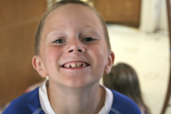 lost tooth won game