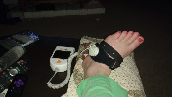 Does this little magical puppy work?  Who knows!  You can't feel ultrasound waves, so there's no way of checking whether it works!  But it's been forcing me to sit still for at least 20 minutes a day, so there has to be some side benefit.