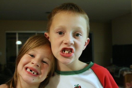 matching missing teeth
